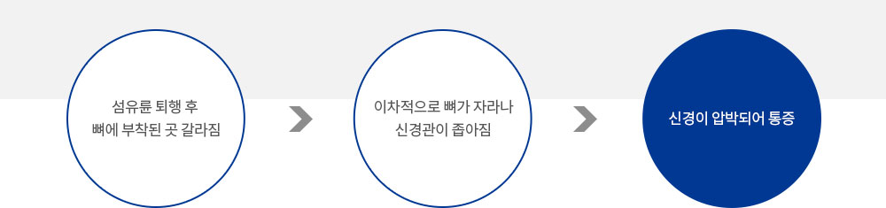 협착증 증상