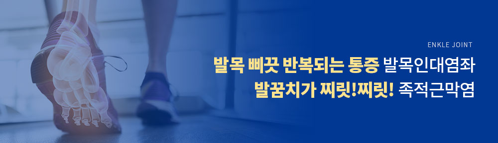 발목인대염좌, 족저근막염